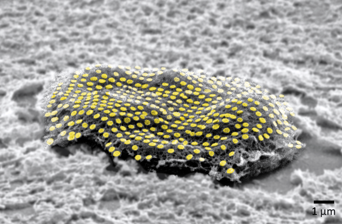 False-colored gold nanodot array on a fibroblast cell. @ Kam Sang Kwok and Soo Jin Choi, Gracias Lab/Johns Hopkins University