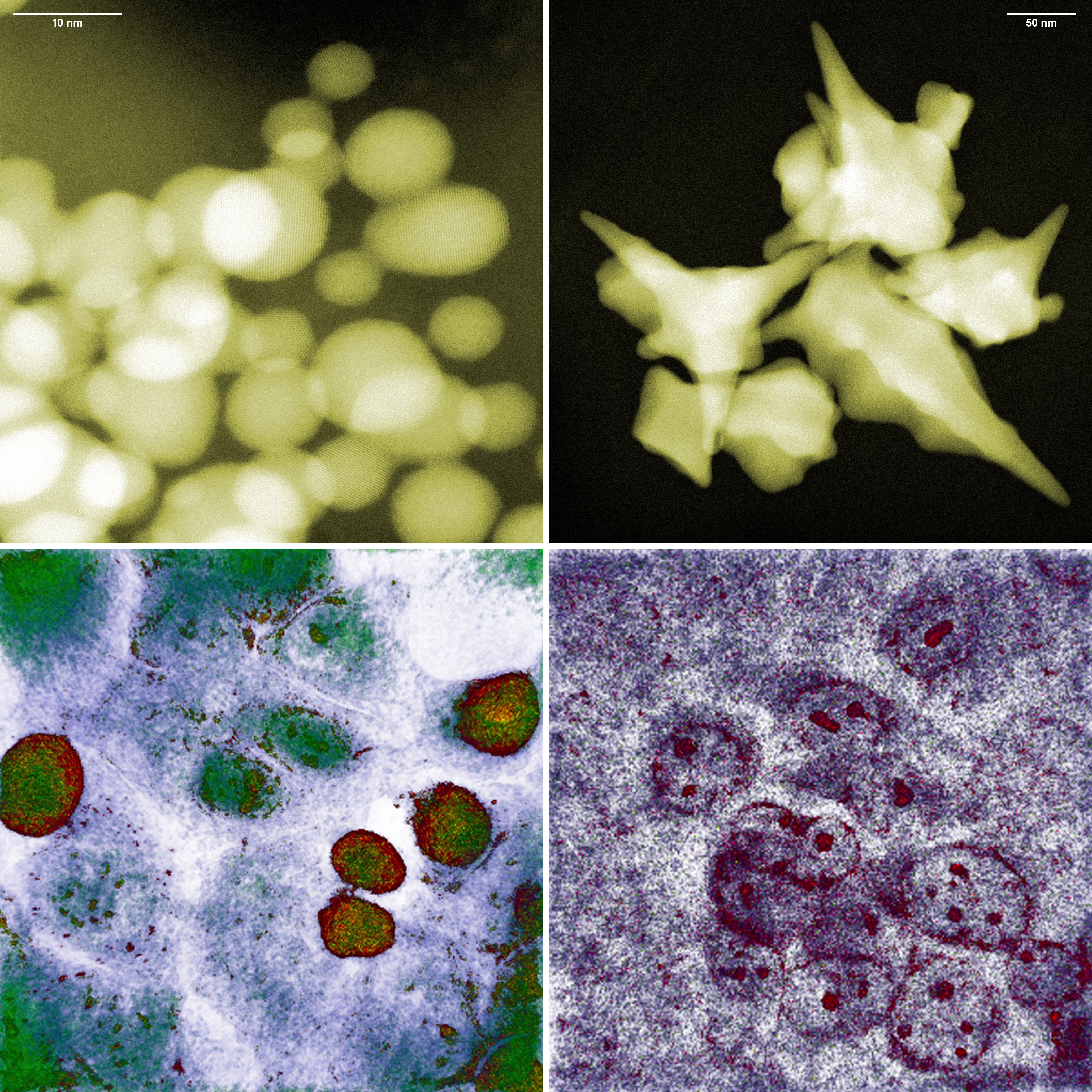 Spherical and star-shaped gold nanoparticles (top) and colon cancer cells after approx. five hours of exposure to them (bottom, respectively). The photo in the bottom left corner proves that, despite the small size of the spherical nanoparticles, the cancer cells survived. False colors. @ IFJ PAN