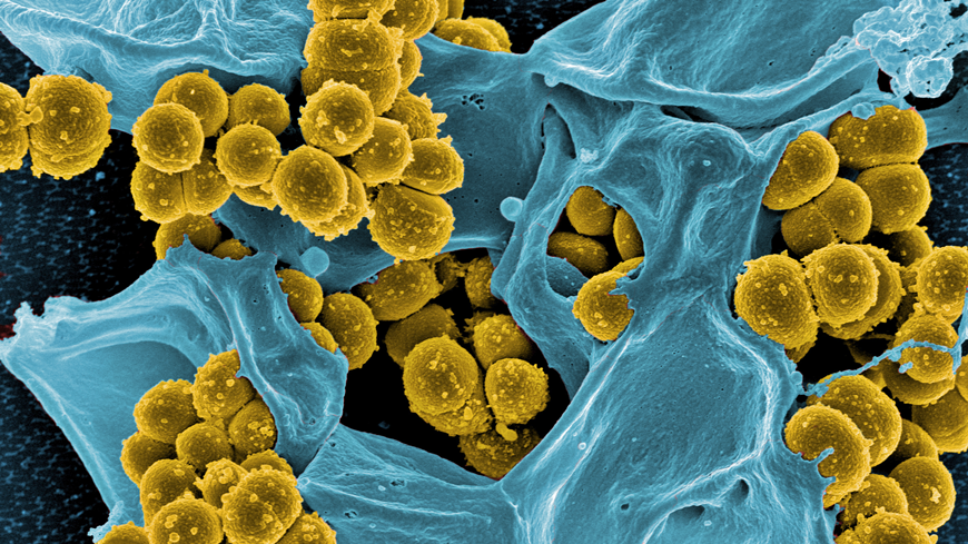Antibiotic-resistant staphylococci (yellow) are fought by a white blood cell (blue). @ NIAID, digitally colored (Empa)
