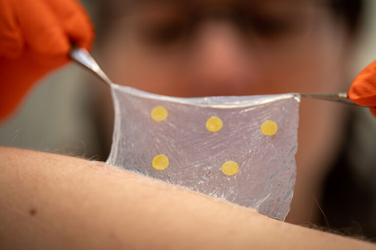 The wound dressing is made of tight mesh nanocellulose, preventing bacteria and other microbes from getting in. At the same time, the material lets gases and liquid through. @ Olof Planthaber
