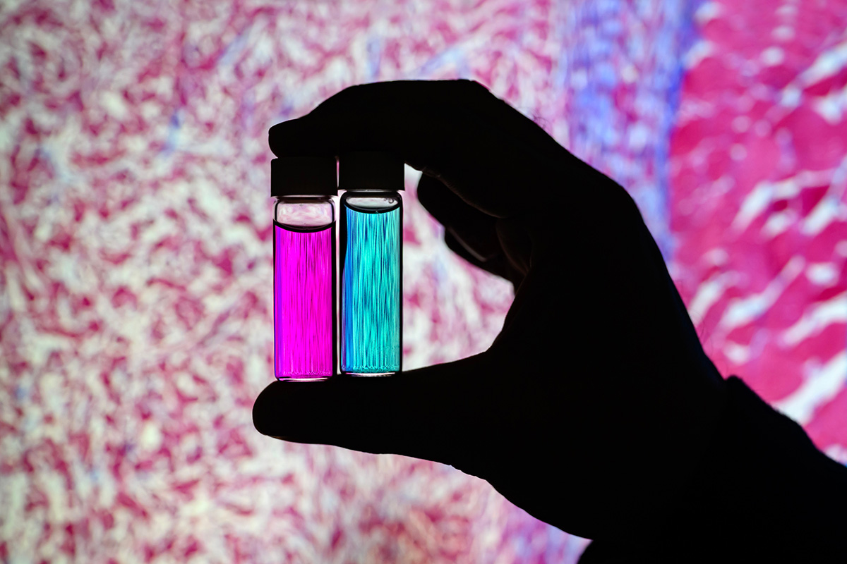 Researcher Indrajit Srivastava holds solutions of nanoparticles that can target two cancer biomarkers, giving off two distinct signals when lit by one fluorescent wavelength. This could give surgeons a more complete picture of a tumor and guide operating-room decisions. In the background is a microscopic scan of a tissue sample. @ Fred Zwicky