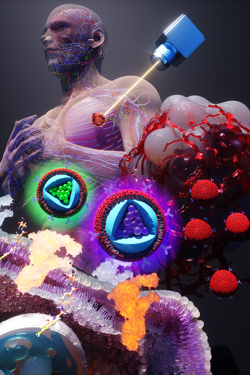 One wavelength of laser light during surgery elicits two distinct signals from the membrane-wrapped nanoparticles, one color for each of the two biomarkers that the nanoparticles target. One is common in earlier stages of cancer, and the other indicates later-stage – and possibly metastatic – cancer. @ Ella Maru Studios