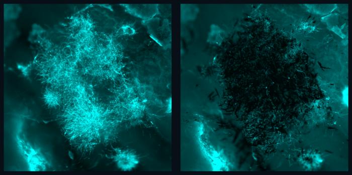 The picture above shows a before (left) and after (right) fluorescence image of fungal aggregates being effectively removed by nanozyme microrobots without bonding to or disturbing the tissue sample. @ Min Jun Oh and Seokyoung Yoon