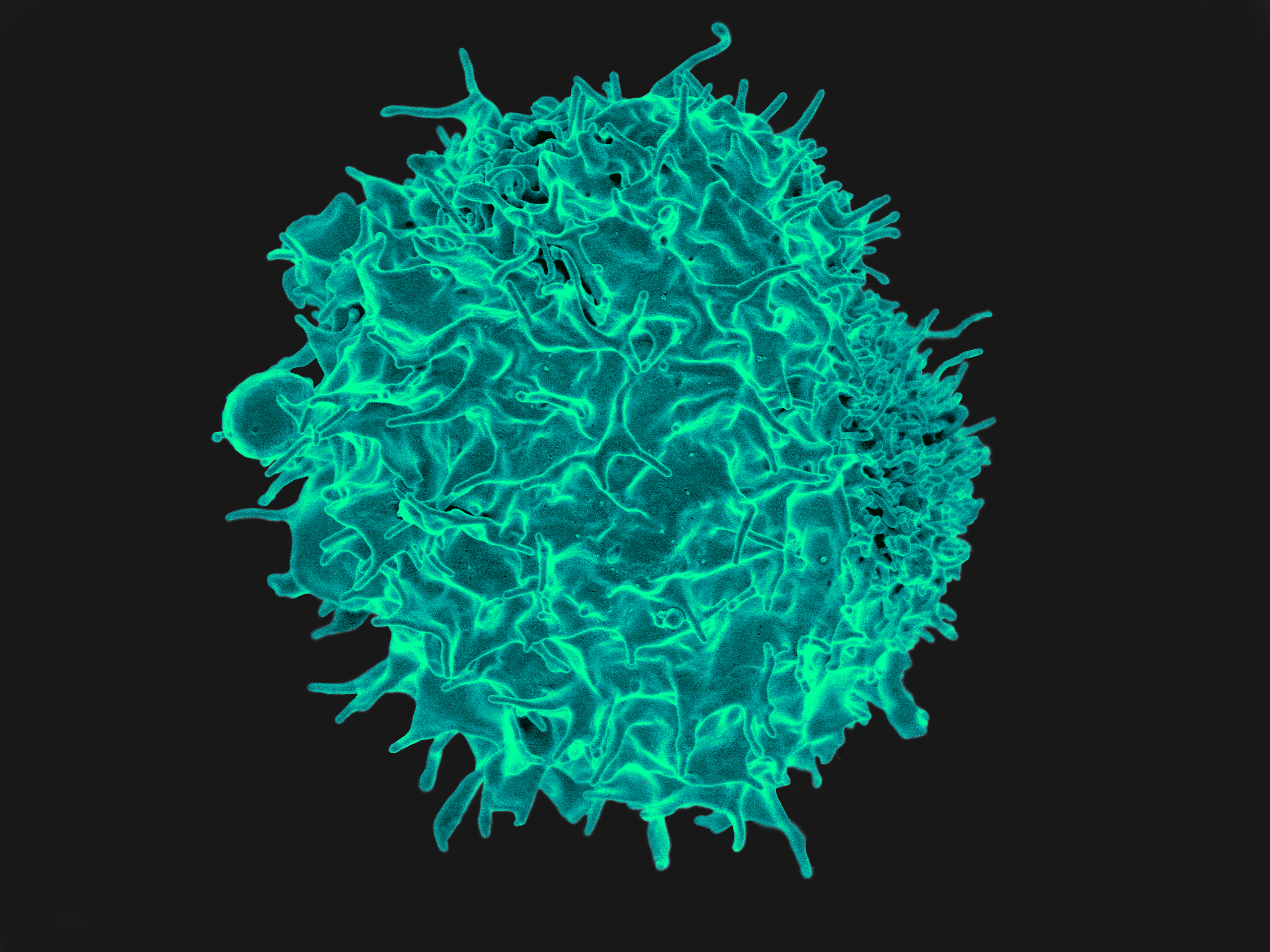 Colorized scanning electron micrograph of a T lymphocyte. @ NIAID