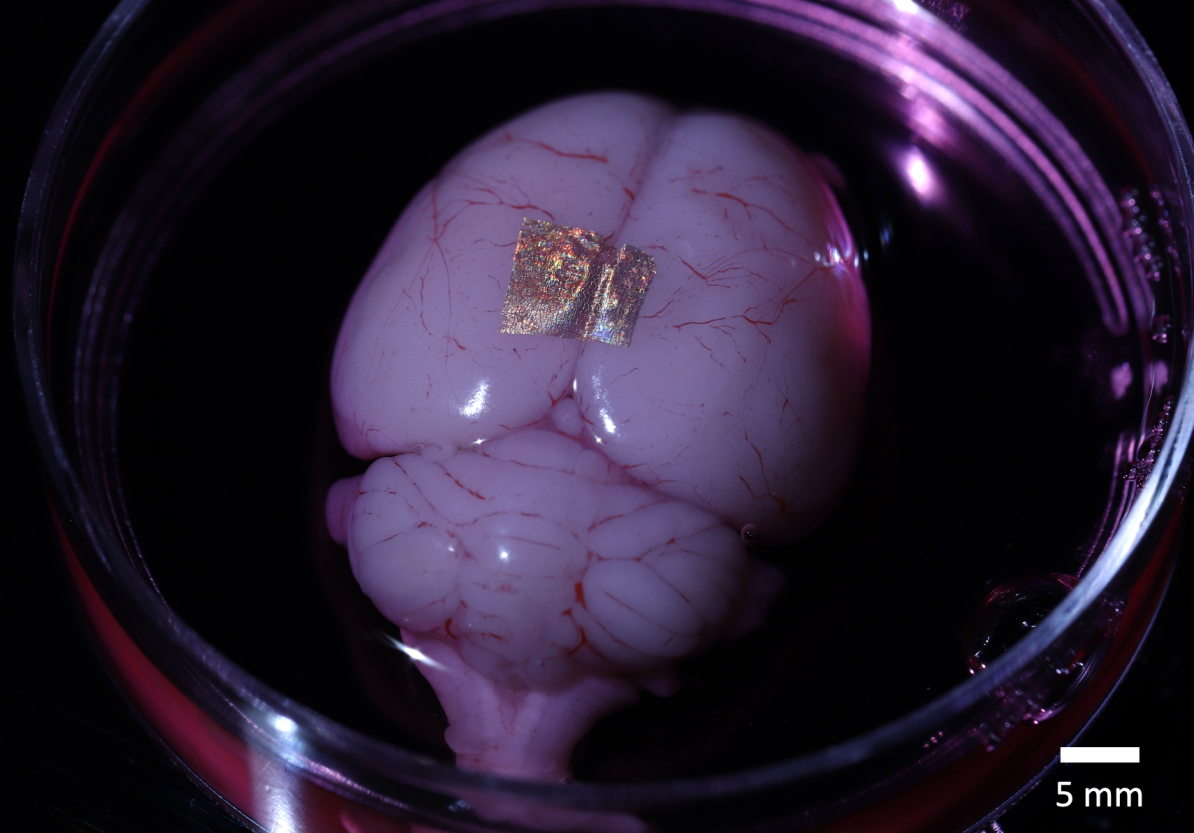 Gold nanowire array on a rat brain. @ Kam Sang Kwok and Soo Jin Choi, Gracias Lab/Johns Hopkins University