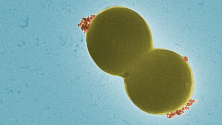 Magnetic nanoparticles (red) bind specifically to the spherical bacteria (yellow) which are about 1 µm in size (electron microscopy digitally colored). @ Empa