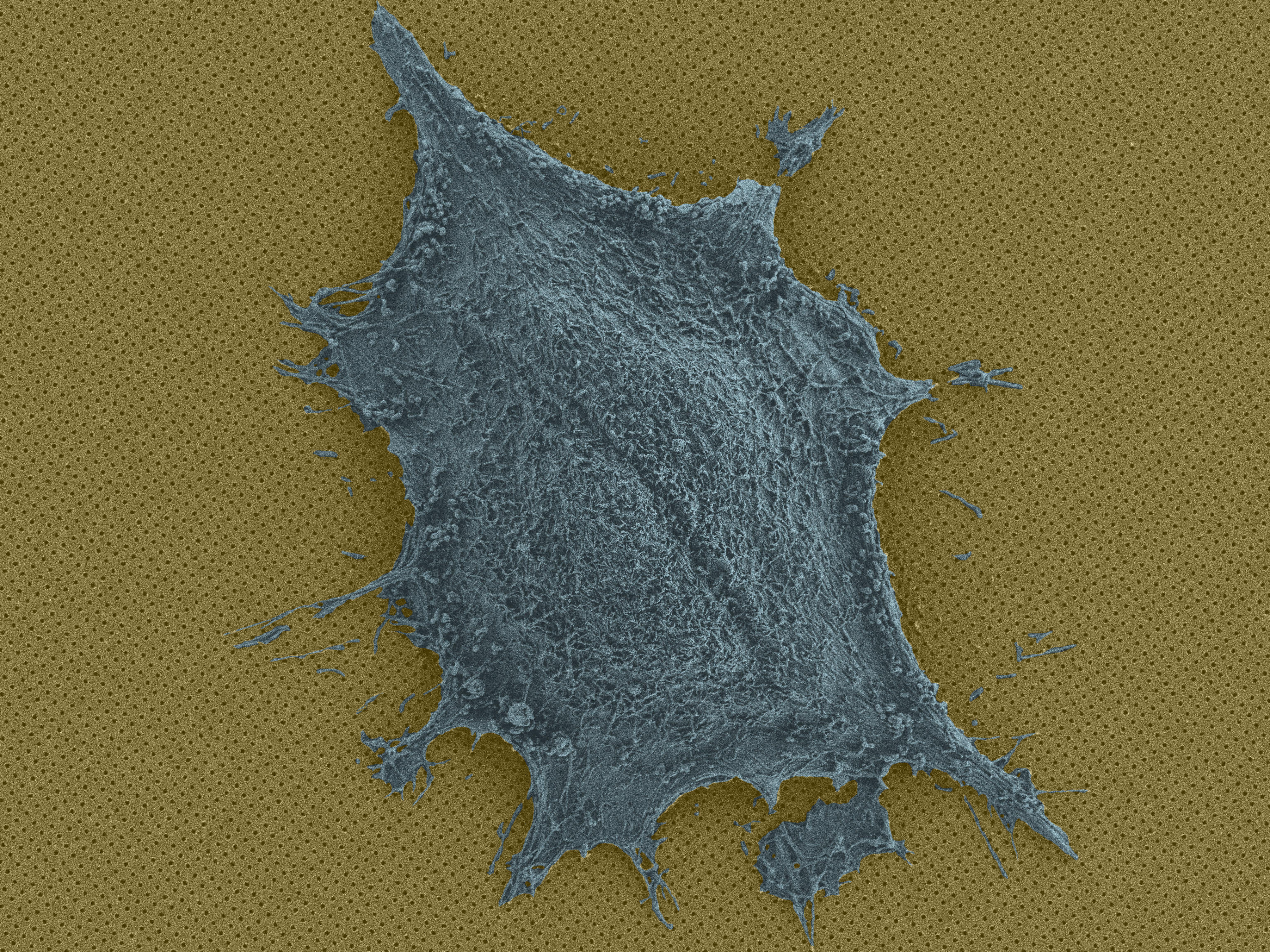 Single cell on a chip. @ BIOS EPFL