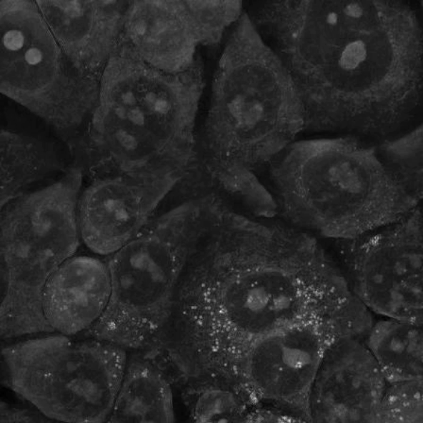 Colon cancer cells after interaction with small spherical gold nanoparticles did not change their morphology and are still able to divide. @ IFJ PAN