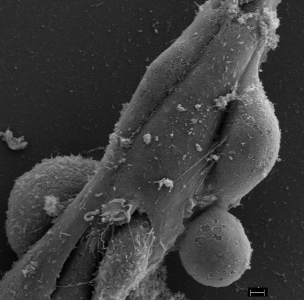 A cancer cell (bottom center) creates a gap and enters the endothelial tube. Another cancer cell (middle right) sends out nanotubes to connect with endothelial cells. Image: Sengupta Lab