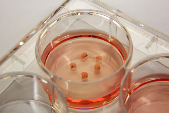 Midbrain organoids, measuring about 3 mm across, cultured in the laboratory dish. Note the black pigments are neuromelanin. Copyright: A*STAR’s Genome Institute of Singapore