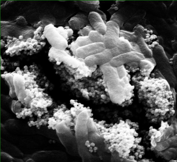 Clusters of nanoparticles with phage viruses attached find and kill Escherichia coli bacteria in a lab test at Rice University. Researchers at Rice and the University of Science and Technology of China have developed a combination of antibacterial phages and magnetic nanoparticle clusters that infect and destroy bacteria that are usually protected by biofilms in water treatment systems. @ Alvarez Group/Rice University