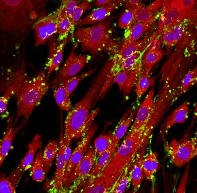 Immunohistochemical imaging of female human amniotic stem cells incubated with nanoparticles demonstrated a significant increase in uptake compared to male cells. (Green: quantum dots representing nanoparticles; red: cell staining; blue: nuclei) @ Morteza Mahmoudi, Brigham and Women's Hospital