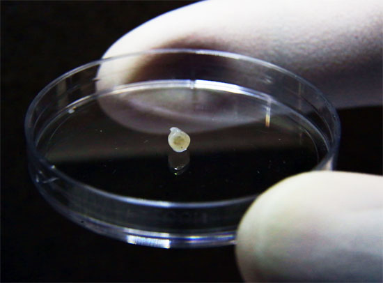 A midbrain organoid in a petri dish. The black pigment is neuromelanin, a hallmark of the human midbrain. Copyright: A*STAR’s Genome Institute of Singapore