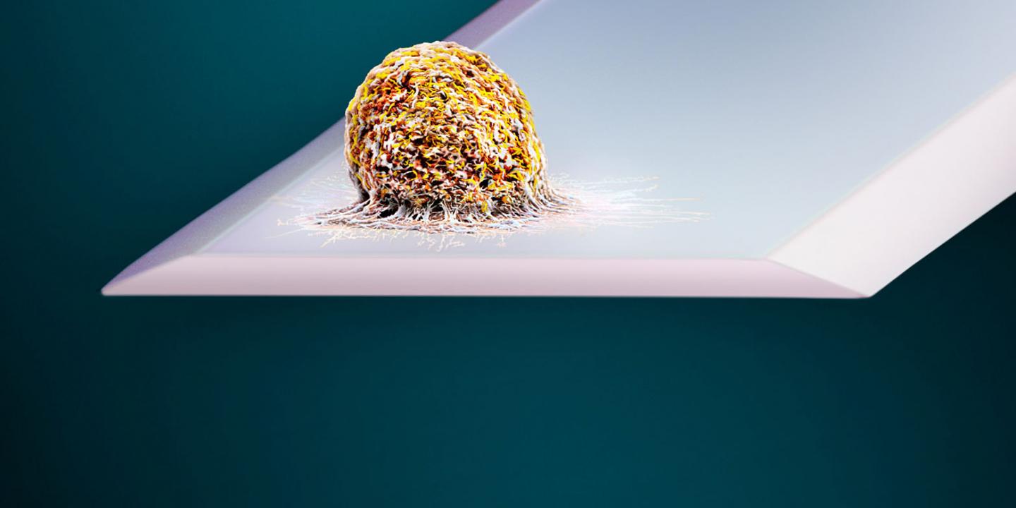 A human cell is attached to a cantilever: ETH Zurich researchers have developed a highly sensitive scale that measures the weight of a single cell. (Picture: Martin Oeggerli, micronaut.ch / ETH Zurich / University of Basel) @ Martin Oeggerli, www.micronaut.ch / ETH Zurich / University of Basel