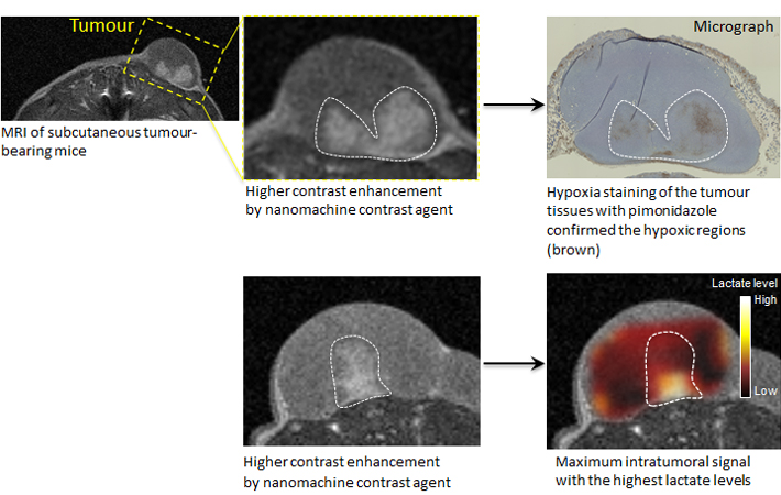 Figure 2. The nanomachine contrast agent may not only detect cancer with an MRI but also be effective in diagnosing its internal structure and malignancy. The nanomachine contrast agent produced stronger signals and made white the regions of low oxygen concentration and low pH levels thought to be especially malignant, even among cancer tissue. This effect was stronger in low-cost MRIs using lower magnetic fields. This means that MRI equipment existing at clinical sites can be used, and this new technology is expected to aid in diagnosing the degree of malignancy of cancers and their resistance to treatment.