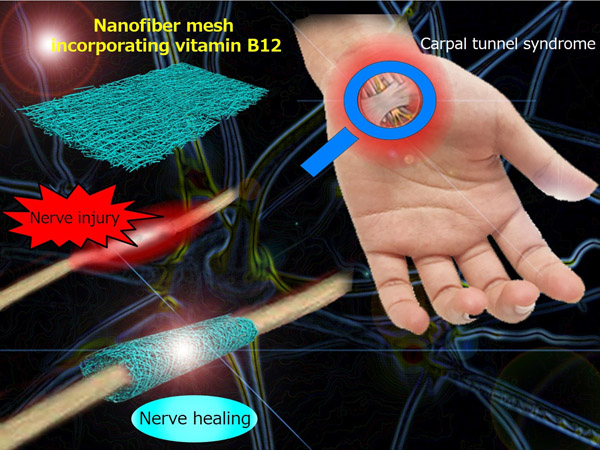 Conceptual diagram showing a nanofiber mesh incorporating vitamin B12 and its application to treat a peripheral nerve injury.