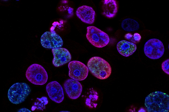 Human colorectal cancer cells @ NCI Center for Cancer Research