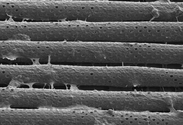 This is a scanning electron microscopy image of endothelial cells cultured on the tubular scaffold. The cells built a biological barrier resulting in a biohybrid system which resembles its natural model. @ IIT-Istituto Italiano di Tecnologia