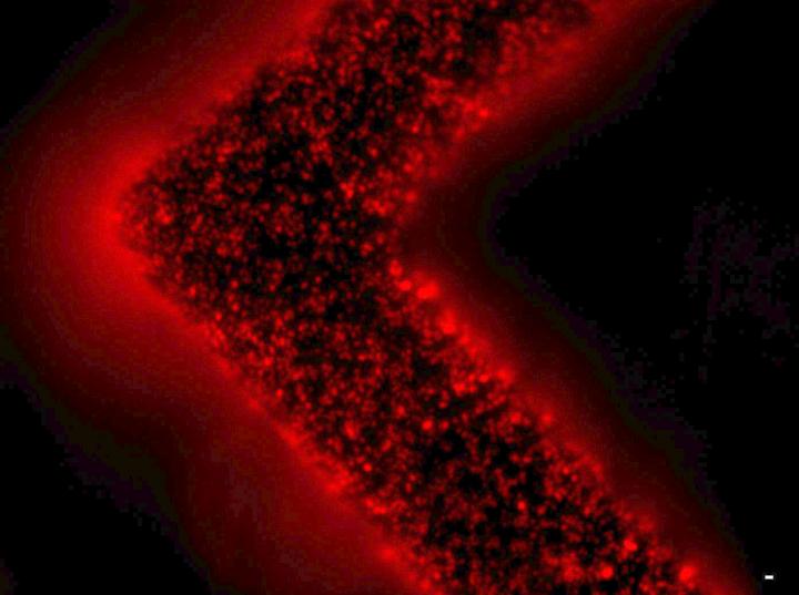 Extracellular vesicles (red) released from a patient's tumor and captured on the surfaces of the EVHB-Chip. @ Shannon Stott, PhD, Center for Engineering in Medicine, Massachusetts General Hospital