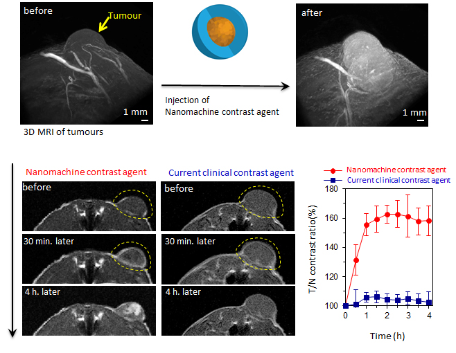 Figure 1. The nanomachine contrast agent makes possible the detection of cancer with a higher contrast than current contrast agents. Further, the regions of higher malignancy inside the tumor mass-produce more intense signals, providing additional information about the structure and the characteristics inside the tumor mass.