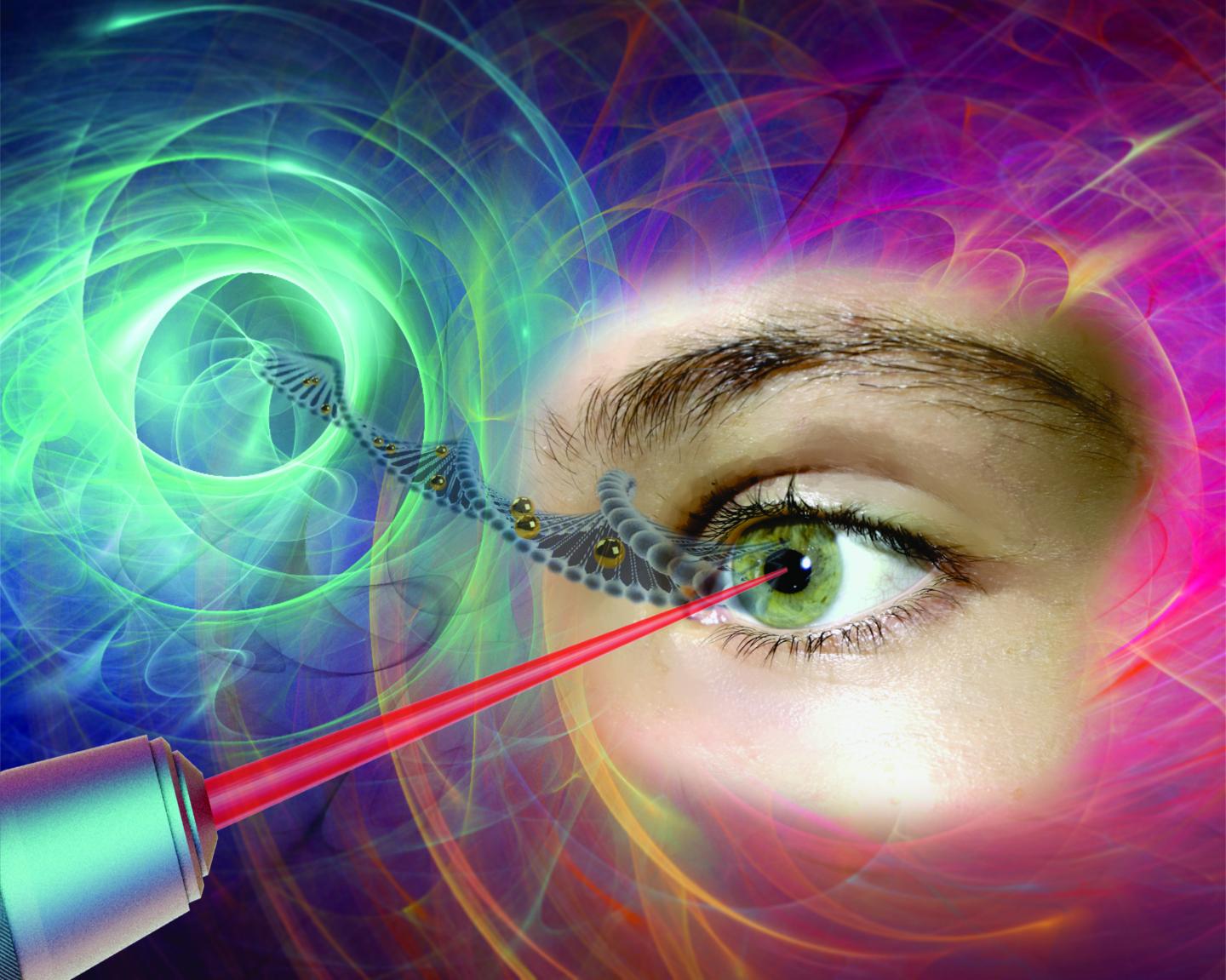 Gold nanoparticles, which act like "nanolenses," concentrate the energy produced by the extremely short pulse of a femtosecond laser to create a nanoscale incision on the surface of the eye's retina cells. This technology, which preserves cell integrity, can be used to effectively inject drugs or genes into specific areas of the eye, offering new hope to people with glaucoma, retinitis or macular degeneration. @ Polytechnique Montréal