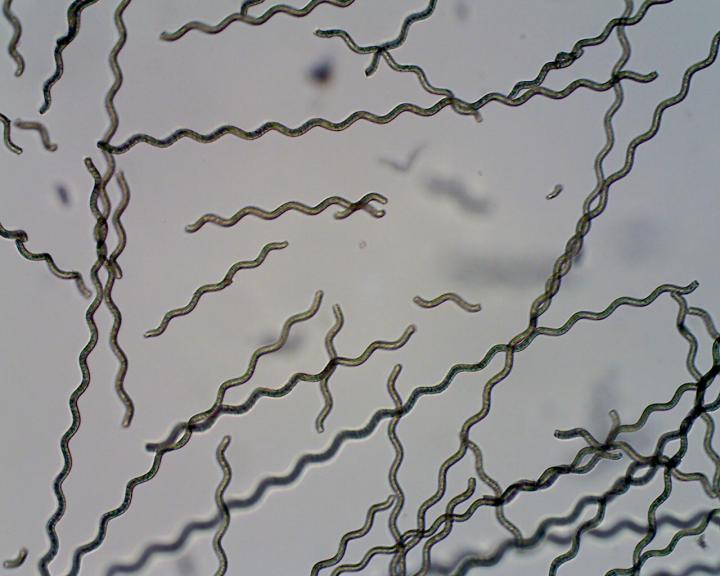 Spirulina algae coated with magnetic particles to form a microrobot. Devices such as these could be developed to diagnose and treat illness in hard-to-reach parts of the body. @ Yan et al Science Robotics 2017