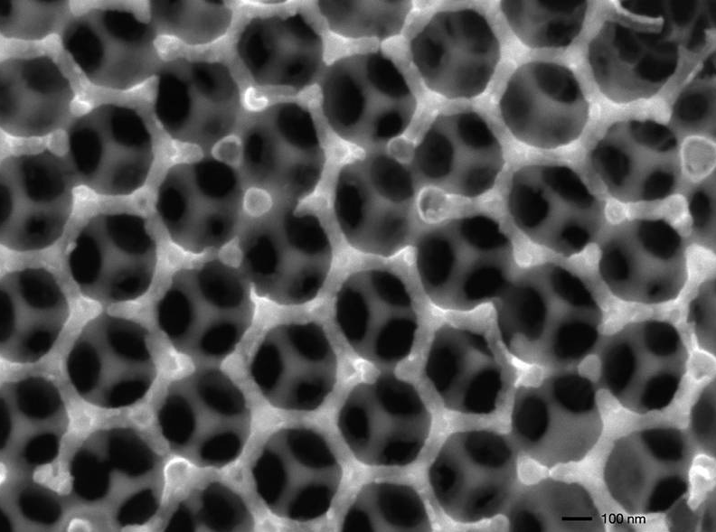 Electronmicroscopical image of the germanium-structure after removal of the polymer templates – Image: Katia Rodewald / TUM
