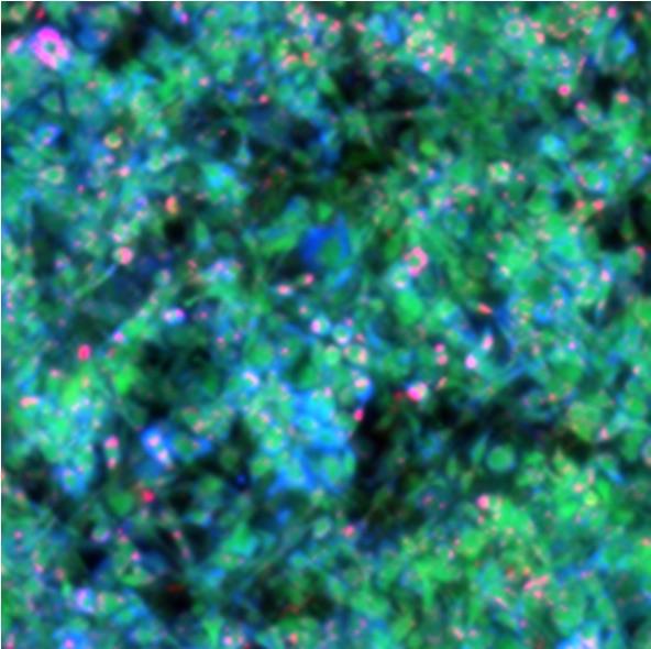 Living adipocytes (1mm x 1mm): lipids (red), proteins (green), and carbohydrates (blue). @ Helmholtz Zentrum München / Miguel A. Pleitez