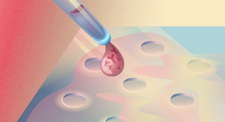 Russian researchers have developed a novel method for diagnosing and monitoring autoimmune disorders. Within a mere 25 minutes, their new biosensor not only measures the concentration of autoantibodies in human blood serum with extremely high sensitivity, but also -- for the first time -- quantifies their activity. The combination of these parameters permits the elaboration of new diagnostic criteria for autoimmune diseases, as well as new approaches to their treatment. @ Daria Sokol/MIPT Press Office