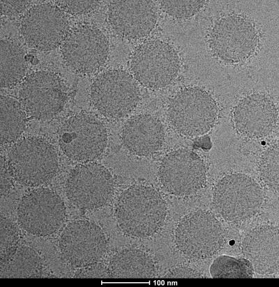 Transmission electron microscopy image showing the formation of biomolecular corona around the surface of nanoparticles. @ Morteza Mahmoudi, Brigham and Women's Hospital