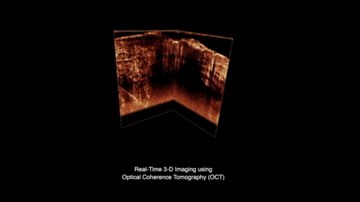 Real-time 3D imaging using Optical Coherence Tomography (OCT) @ Biophotonics Imaging Lab at the Beckman Institute for Advanced Science and Technology