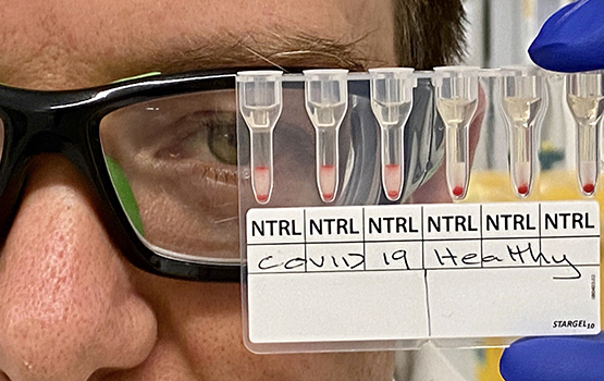 World-first research, led by Monash University, has been able to identify positive COVID-19 cases using blood samples in approximately 20 minutes. @ Monash University