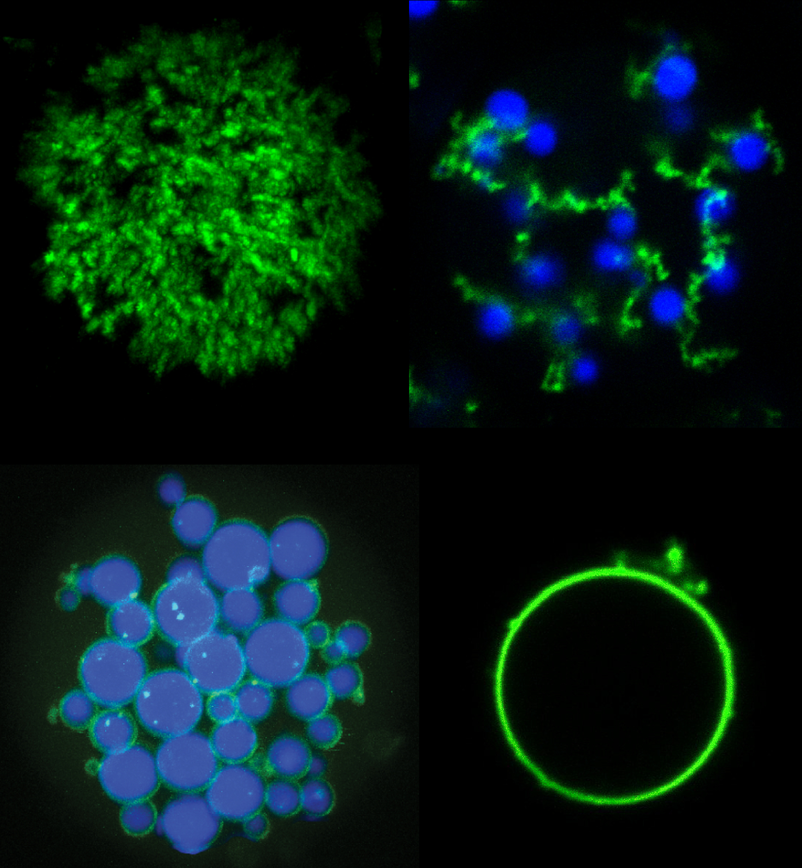 Mixtures of POPs (green) and ELPs (blue) can be used to create a variety of new microparticle architectures including (clockwise from upper left) porous particles, 'fruits-on-a-vine' networks, single hollow 'vesicle-like' particles, and core-shell networks. @ Stefan Roberts, Duke University