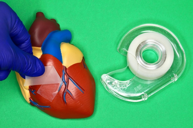 “This is like a painless Band-Aid for internal organs,” says Xuanhe Zhao, professor of mechanical engineering and of civil and environmental engineering at MIT. “You put the adhesive on, and if for any reason you want to take it off, you can do so on demand, without pain.” @ MIT