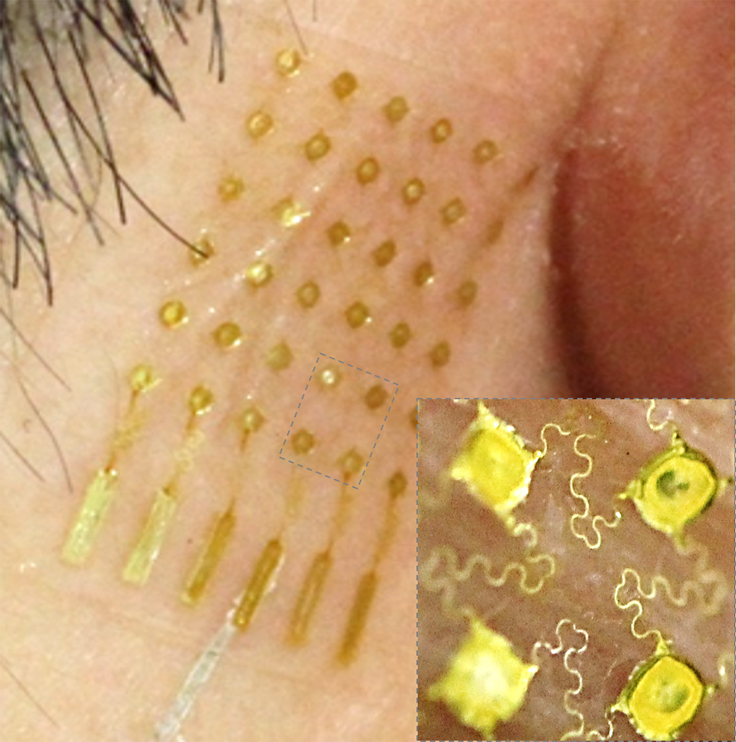 An aerosol-jet printed stretchable, skin-like electrode with an open-mesh structure shown in inset.@ Woon-Hong Yeo