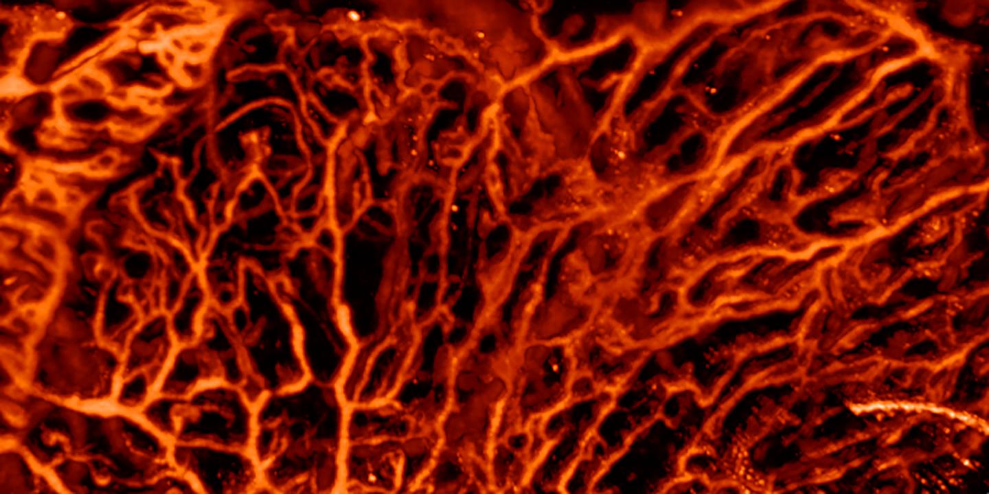 Optoacoustic imaging is particularly good at visualizing blood vessels. @ ETH Zurich / Daniel Razansky