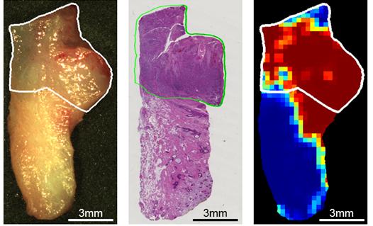 This composite image shows how noninvasive hyperspectral imaging (right) compares to a current microscope method (center) in identifying cancer cells. The original tissue sample is on the left. @ University of Texas at Dallas