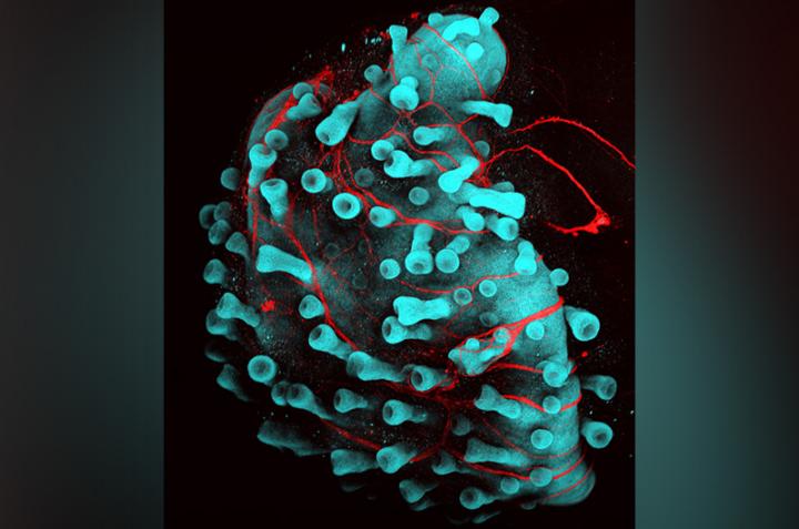 A cultured human skin cell with developing hair follicles (budding protusions) and embedded nerves (in red). @ Jiyoon Lee, Boston Children's Hospital