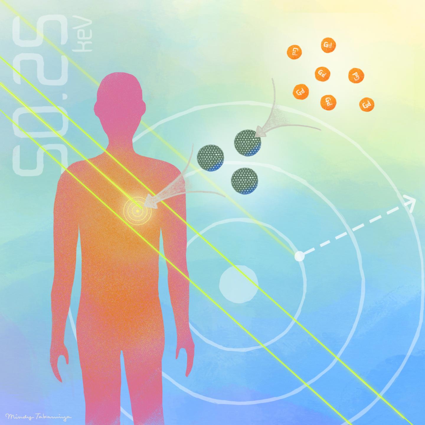 Precisely tuned X-ray can target give cancer cells more effective punch without harming body's surface, using gadolinium loaded silicon porous silica particles. @ Mindy Takamiya