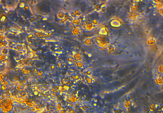 HL-1 cardiomyocytes grown in the chip and exposed to lowered levels of oxygen (hypoxia) exhibit slowed and irregular beat rate which mimics arrhythmia observed in cardiac arrest. @ Brian Timko, Tufts University