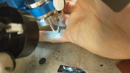 Duke graduate student Nick Williams prints two electronically active leads along the underside of his pinky finger, places small LED light between them, and applies a voltage to show the circuit stays intact even when he bends his finger. @ Nick Williams, Duke University