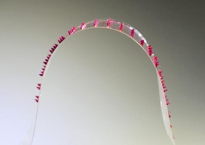 Microneedles, made of a biomaterial mixed with therapeutic agents, are attached to a strip of tape, needles facing down. The strip is applied to the wound area of the skin and the tape removed. The needles are embedded into the skin and degrade, delivering the therapeutic agent under the skin. @ Khademhosseini Lab