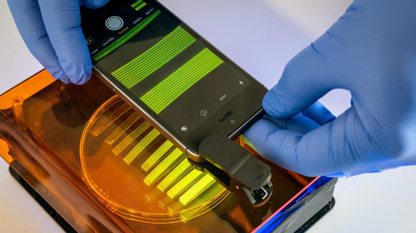 Dr Nuno Reis from the University of Bath has developed a test to detect E. coli in urine samples that uses a smartphone camera @ University of Bath
