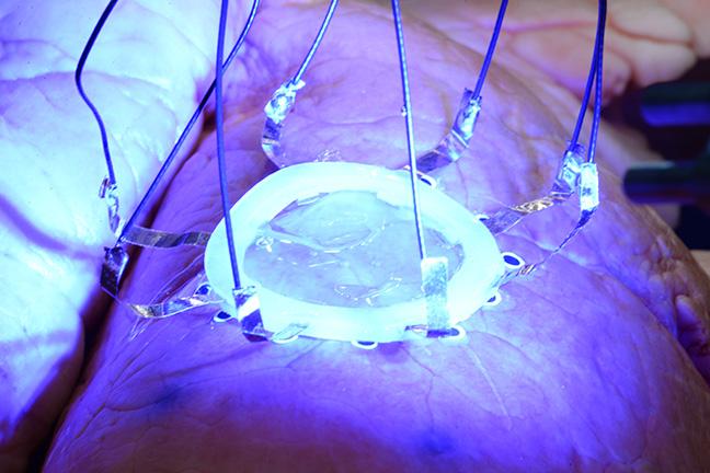 A new technique developed by University of Minnesota researchers allows 3D printing of hydrogel-based sensors directly on organs, like the lungs, that change shape or distort due to expanding and contracting. @ McAlpine Research Group, University of Minnesota