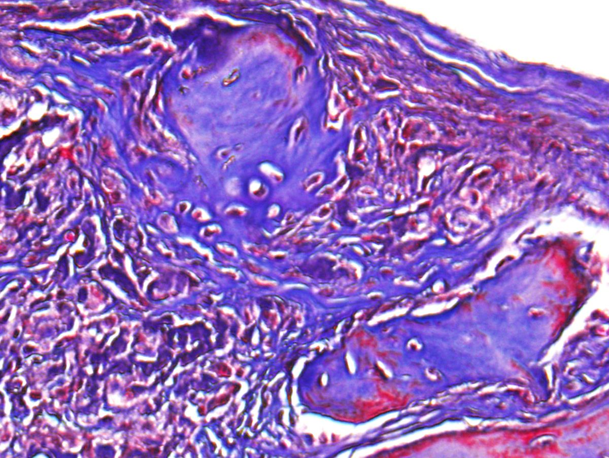 Microscopic image of regenerated bone in a skull defect in a mouse. @ UCLA