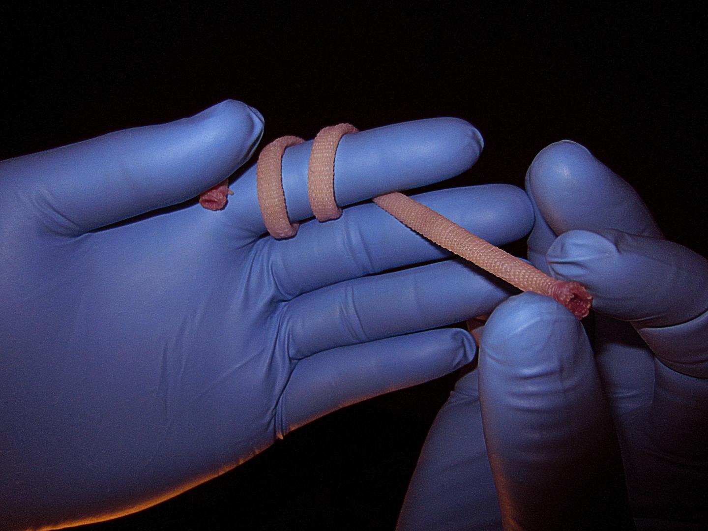 Researchers used threads made of human tissue to weave blood vessels. The new textile-based approach doesn't require any synthetic materials, so the blood vessels are less likely to be rejected by the body. @ Nicolas L'Heureux, Inserm/University of Bordeaux, France