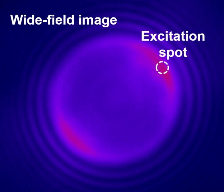 Miniaturising laser devices poses significant challenges for nanoscale biological applications